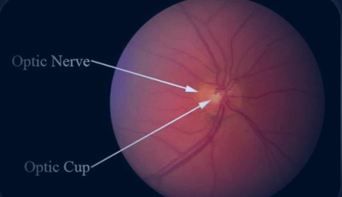 Retina image with optic nerve and cup